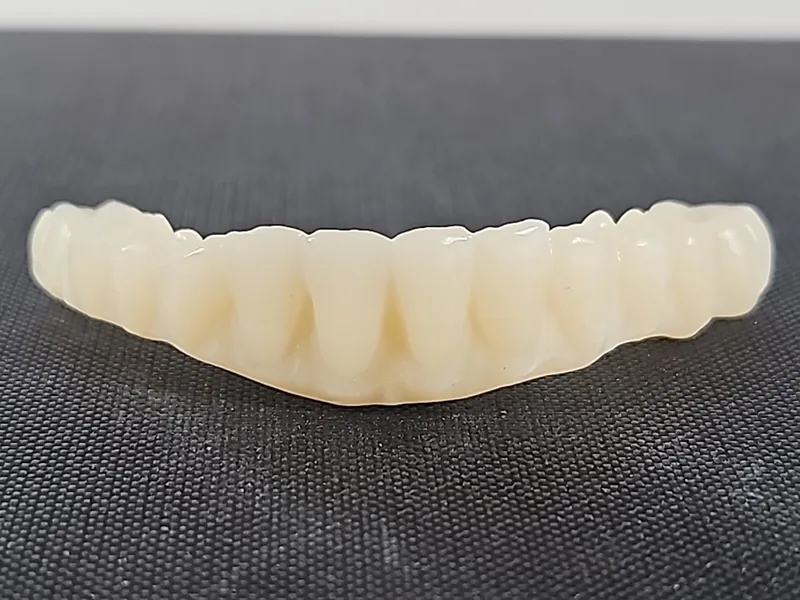 Prototipo full-arch stampato, vista frontale