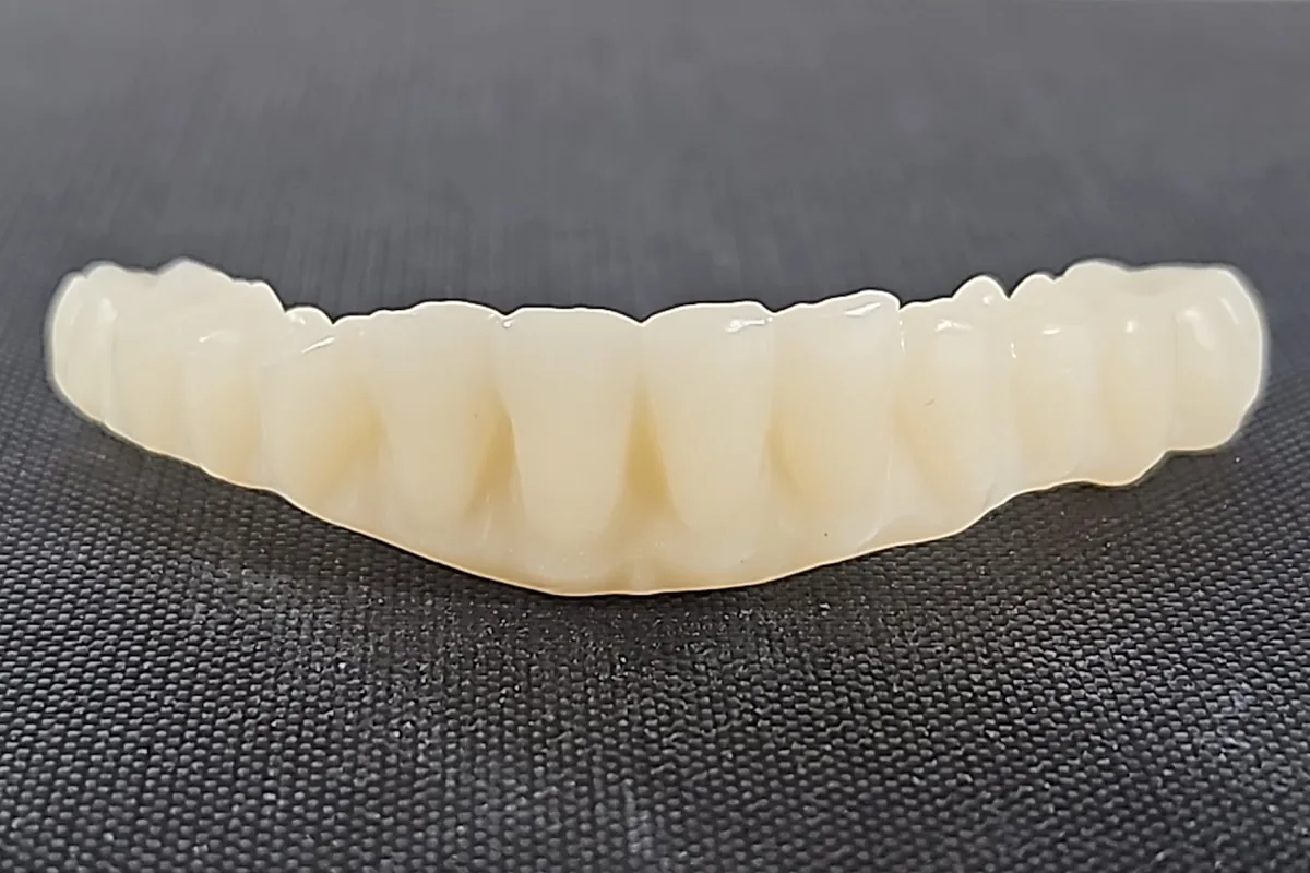 Prototipo full-arch stampato, vista frontale