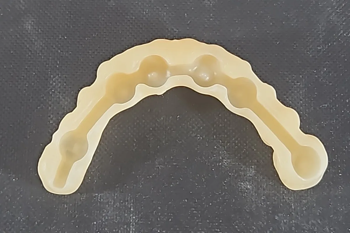 Modello stampato in 3D con i fori per gli impianti, vista occlusale