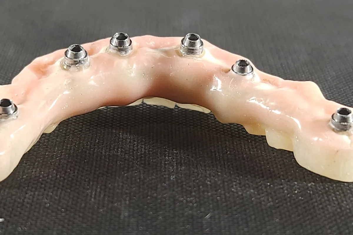 Struttura full-arch avvitata sul modello con monconi e viti