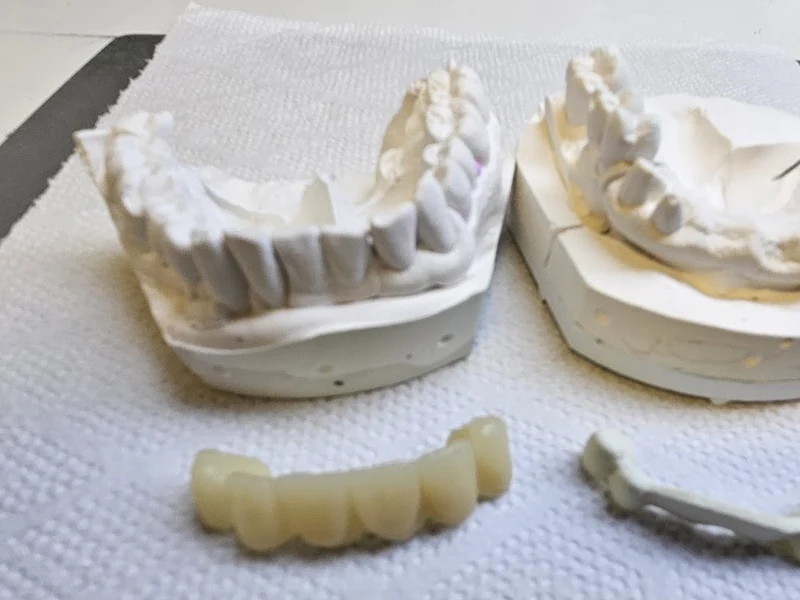 Modelli in gesso e barre di supporto