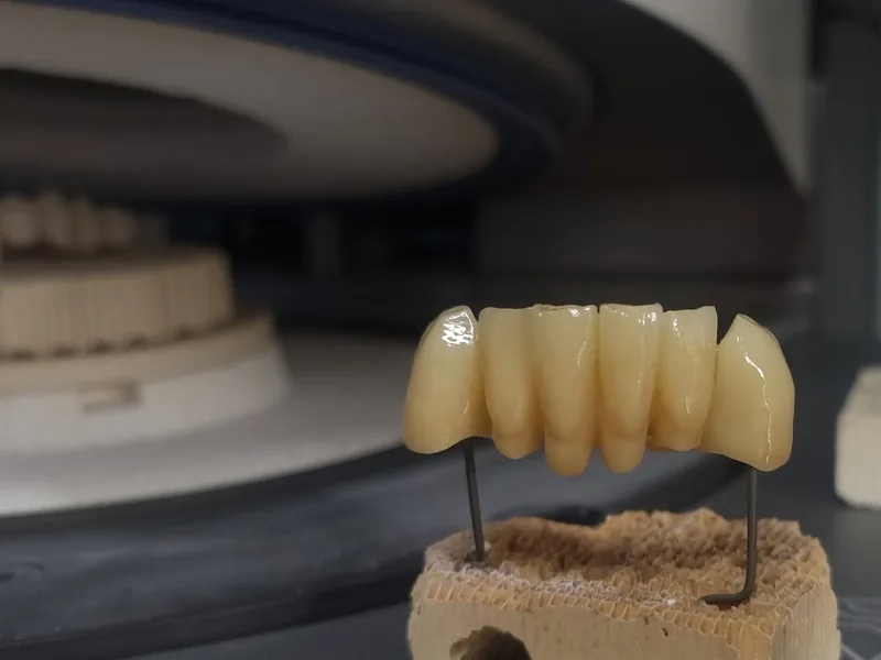 Ponte in zirconia sul supporto di sinterizzazione
