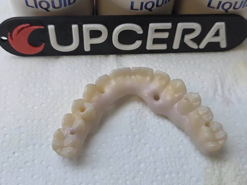 Arcata in zirconia, vista occlusale