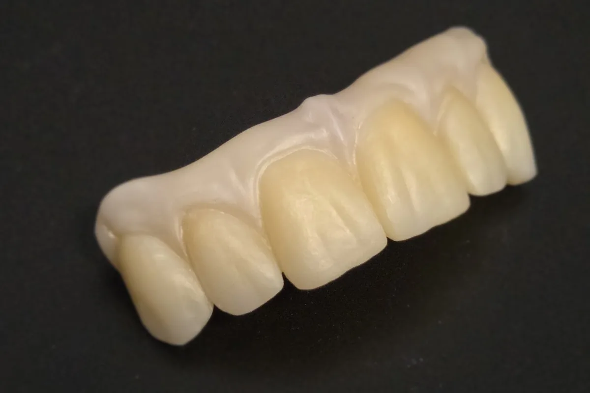 Arcata anteriore in zirconia colorata, vista di tre quarti su fondo scuro